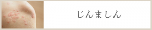 じんましん