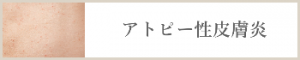 アトピー性皮膚炎