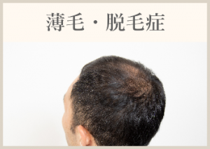 薄毛・脱毛症