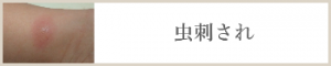 虫刺され