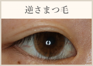 逆さまつ毛