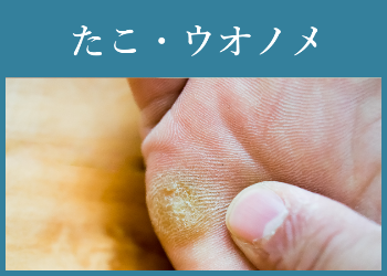 たこ・ウオノメ