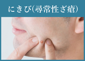 にきび(尋常性ざ瘡)