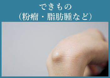 できもの(粉瘤・脂肪腫など)