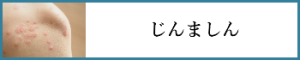 じんましん
