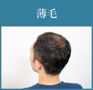 薄毛