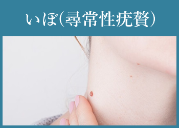 いぼ(尋常性疣贅)