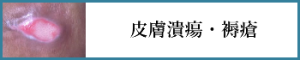 皮膚潰瘍・褥瘡