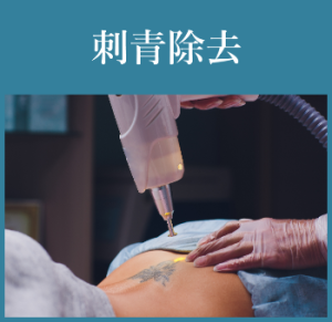 刺青除去