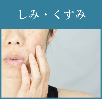 しみ・くすみ